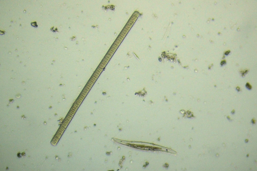 Alghe azzurre al microscopio